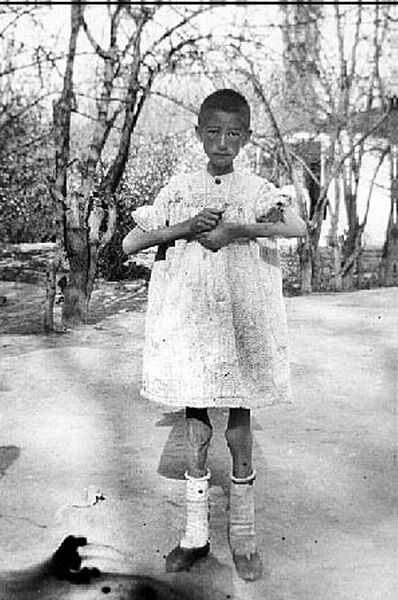 Refugee orphan at Erivan. Like many others, she carried the marks of forced starvation.