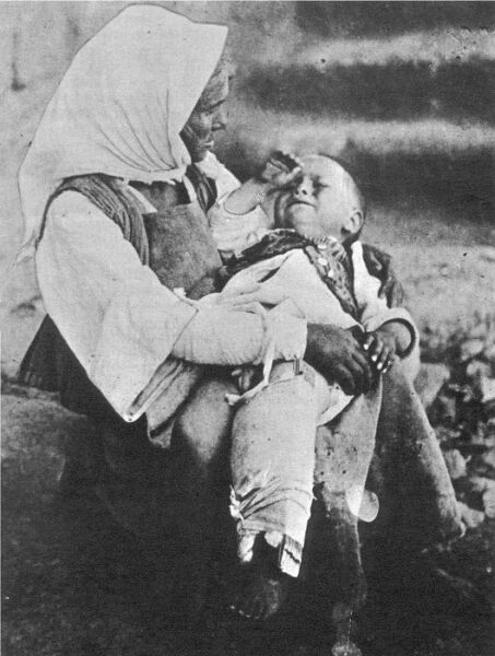 Hellenic refugees. A woman a small child, who probably had a broken leg.