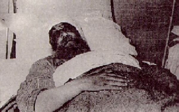 The Abbot of the Monastery of Zoodochos at the Baloukli hospital after being tortured by the Turks.